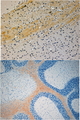MAPK8IP3 / JIP3 Antibody - Goat Anti-JIP3 / Syd2 / JSAP1 Antibody (4µg/ml) staining of paraffin embedded Mouse Brain. Steamed antigen retrieval with citrate buffer pH 6, HRP-staining.