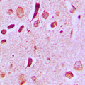 MAPK8IP3 / JIP3 Antibody - Immunohistochemical analysis of JIP3 staining in human brain formalin fixed paraffin embedded tissue section. The section was pre-treated using heat mediated antigen retrieval with sodium citrate buffer (pH 6.0). The section was then incubated with the antibody at room temperature and detected using an HRP conjugated compact polymer system. DAB was used as the chromogen. The section was then counterstained with hematoxylin and mounted with DPX.