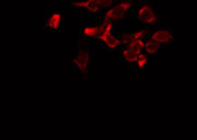 MAPK8IP3 / JIP3 Antibody - Staining HeLa cells by IF/ICC. The samples were fixed with PFA and permeabilized in 0.1% Triton X-100, then blocked in 10% serum for 45 min at 25°C. The primary antibody was diluted at 1:200 and incubated with the sample for 1 hour at 37°C. An Alexa Fluor 594 conjugated goat anti-rabbit IgG (H+L) Ab, diluted at 1/600, was used as the secondary antibody.
