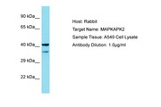 MAPKAPK2 / MAPKAP Kinase 2 Antibody -  This image was taken for the unconjugated form of this product. Other forms have not been tested.