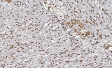 MAPKAPK3 Antibody - 1:100 staining human Smooth muscle tissue by IHC-P. The tissue was formaldehyde fixed and a heat mediated antigen retrieval step in citrate buffer was performed. The tissue was then blocked and incubated with the antibody for 1.5 hours at 22°C. An HRP conjugated goat anti-rabbit antibody was used as the secondary.