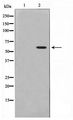MAPKAPK5 / PRAK Antibody - Western blot of K562 cell lysate using Phospho-MAPKAPK5(Thr182) Antibody