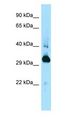 MAPRE1 / EB1 Antibody - MAPRE1 antibody Western Blot of Mouse Spleen.  This image was taken for the unconjugated form of this product. Other forms have not been tested.