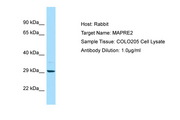 MAPRE2 / EB2 Antibody -  This image was taken for the unconjugated form of this product. Other forms have not been tested.