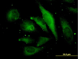 MAPRE2 / EB2 Antibody - Immunofluorescence of monoclonal antibody to MAPRE2 on HeLa cell (antibody concentration 35 ug/ml).