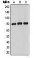 MARCKS Antibody - Western blot analysis of MARCKS (pS163) expression in MCF7 PMA-treated (A); SP2/0 PMA-treated (B); PC12 PMA-treated (C) whole cell lysates.