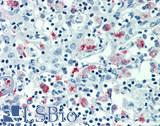 MARCO Antibody - Human Thymus: Formalin-Fixed, Paraffin-Embedded (FFPE)