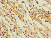 MARCO Antibody - Immunohistochemistry of paraffin-embedded human lung tissue at dilution 1:100