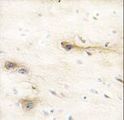 MARK1 / MARK Antibody - Formalin-fixed and paraffin-embedded human brain tissue reacted with MARK1 Antibody , which was peroxidase-conjugated to the secondary antibody, followed by DAB staining. This data demonstrates the use of this antibody for immunohistochemistry; clinical relevance has not been evaluated.