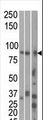 MARK1 / MARK Antibody - The anti-MARK1 C-term antibody is used in Western blot to detect MARK1 in, from left to right, HeLa, T47D, and mouse brain cell line/ tissue lysate.