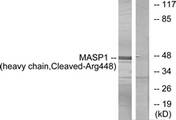 MASP1 / MASP Antibody - Western blot of extracts from A549 cells, treated with etoposide 25 uM 24h, using MASP1 (heavy chain, Cleaved-Arg448) Antibody. The lane on the right is treated with the synthesized peptide.