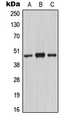 MASP1 / MASP Antibody - Western blot analysis of MASP1 HC expression in A549 colchicine-treated (A); mouse lung (B); rat liver (C) whole cell lysates.