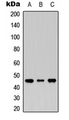MASP1 / MASP Antibody - Western blot analysis of MASP1 LC expression in HEK293T (A); Raw264.7 (B); H9C2 (C) whole cell lysates.