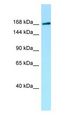 MAST1 Antibody - MAST1 antibody Western Blot of HT1080.  This image was taken for the unconjugated form of this product. Other forms have not been tested.