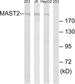 MAST205 / MAST2 Antibody - Western blot analysis of lysates from Jurkat, 293, and HepG2 cells, using MAST2 Antibody. The lane on the right is blocked with the synthesized peptide.
