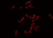 MAST205 / MAST2 Antibody - Staining HeLa cells by IF/ICC. The samples were fixed with PFA and permeabilized in 0.1% Triton X-100, then blocked in 10% serum for 45 min at 25°C. The primary antibody was diluted at 1:200 and incubated with the sample for 1 hour at 37°C. An Alexa Fluor 594 conjugated goat anti-rabbit IgG (H+L) Ab, diluted at 1/600, was used as the secondary antibody.