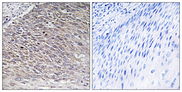MAST4 Antibody - Immunohistochemistry analysis of paraffin-embedded human testis tissue, using MAST4 Antibody. The picture on the right is blocked with the synthesized peptide.