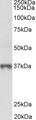 MAT2B Antibody - MAT2B antibody (0.3 ug/ml) staining of Human Thymus lysate (35 ug protein in RIPA buffer). Primary incubation was 1 hour. Detected by chemiluminescence.