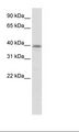 MATH2 / NEUROD6 Antibody - Transfected 293T Cell Lysate.  This image was taken for the unconjugated form of this product. Other forms have not been tested.