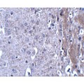MATN4 / Matrilin 4 Antibody - Immunohistochemistry of MATN4 in mouse brain tissue with MATN4 antibody at 2.5 µg/mL.