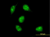 MAX Antibody - Immunofluorescence of monoclonal antibody to MAX on HeLa cell . [antibody concentration 10 ug/ml]