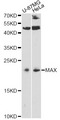 MAX Antibody - Western blot analysis of extracts of various cell lines, using MAX antibody at 1:3000 dilution. The secondary antibody used was an HRP Goat Anti-Rabbit IgG (H+L) at 1:10000 dilution. Lysates were loaded 25ug per lane and 3% nonfat dry milk in TBST was used for blocking. An ECL Kit was used for detection and the exposure time was 90s.