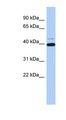 MAZ Antibody - MAZ antibody Western blot of THP-1 cell lysate. This image was taken for the unconjugated form of this product. Other forms have not been tested.