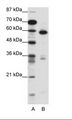MBD1 Antibody - A: Marker, B: Jurkat Cell Lysate.  This image was taken for the unconjugated form of this product. Other forms have not been tested.