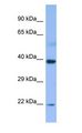 MBIP Antibody - MBIP antibody Western Blot of Fetal Small Intestine.  This image was taken for the unconjugated form of this product. Other forms have not been tested.