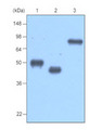 MBP / Maltose Binding Protein Antibody - Recombinant protein MBP-tagged BCDEF, TPD52 and MAGEA3(each 20ng) were resolved by SDS-PAGE, transferred to PVDF membrane and probed with anti-MBP (1:1000). Proteins were visualized using a goat anti-mouse secondary antibody conjugated to HRP and an ECL detection system. Lane 1: MBP-tagged BCDEF protein; Lane 2: MBP-tagged TPD52 protein; Lane 3: MBP-tagged MAGEA3 protein.