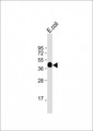 MBP Tag Antibody - Anti-MBP tag Antibody at 1:16000 dilution + E.coli lysate Lysates/proteins at 20 µg per lane. Secondary Goat Anti-Rabbit IgG, (H+L), Peroxidase conjugated at 1/10000 dilution. Predicted band size: 43 kDa Blocking/Dilution buffer: 5% NFDM/TBST.