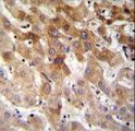 MBTD1 Antibody - MBTD1 Antibody immunohistochemistry of formalin-fixed and paraffin-embedded human liver tissue followed by peroxidase-conjugated secondary antibody and DAB staining.