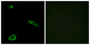 MC2R / ACTHR / ACTH Receptor Antibody - Immunofluorescence analysis of MCF7 cells, using ACTHR Antibody. The picture on the right is blocked with the synthesized peptide.