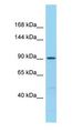 MCC Antibody - MCC antibody Western Blot of MCF7.  This image was taken for the unconjugated form of this product. Other forms have not been tested.