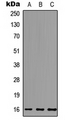 MCFD2 Antibody - Western blot analysis of MCFD2 expression in HEK293T (A); A549 (B); PC12 (C) whole cell lysates.