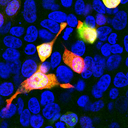 mCherry Antibody - Shows HEK293 cells transfected with mCherry and visualized in red. The cells were stained with mCherry antibody in the green channel, and visualized using a confocal microscope. Transfected cells are yellow, showing overlap of the mCherry and the mCherry antibody antibody. Untransfected HEK293 cells do not express Cherry and do not stain with the antibody, but their nuclei can be visualized using a DNA stain (blue). Blot and transfected cells courtesy of the Semple-Rowland lab at the University of Florida.