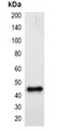 mCherry Tag Antibody - Western blot analysis of over-expressed mCherry-tagged protein in 293T cell lysate.
