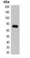 mCherry Tag Antibody - Western blot analysis of over-expressed mCherry-tagged protein in 293T cell lysate.