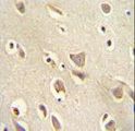 MCHR1 Antibody - MCHR1 antibody immunohistochemistry of formalin-fixed and paraffin-embedded human brain tissue followed by peroxidase-conjugated secondary antibody and DAB staining.