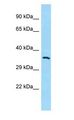 MCHR1 Antibody - MCHR1 antibody Western Blot of 293T.  This image was taken for the unconjugated form of this product. Other forms have not been tested.
