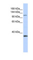 MCM2 Antibody - MCM2 antibody Western blot of Fetal Brain lysate. This image was taken for the unconjugated form of this product. Other forms have not been tested.