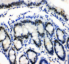 MCM3 Antibody - MCM3 antibody. IHC(P): Rat Intestine Tissue.