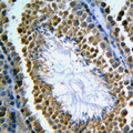 MCM3AP / GANP Antibody - Immunohistochemical analysis of GANP staining in human tonsil formalin fixed paraffin embedded tissue section. The section was pre-treated using heat mediated antigen retrieval with sodium citrate buffer (pH 6.0). The section was then incubated with the antibody at room temperature and detected using an HRP conjugated compact polymer system. DAB was used as the chromogen. The section was then counterstained with hematoxylin and mounted with DPX.