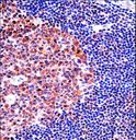 MCM4 Antibody - MCM4 Antibody immunohistochemistry of formalin-fixed and paraffin-embedded human tonsil tissue followed by peroxidase-conjugated secondary antibody and DAB staining.