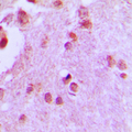 MCM5 Antibody - Immunohistochemical analysis of CDC46 staining in human brain formalin fixed paraffin embedded tissue section. The section was pre-treated using heat mediated antigen retrieval with sodium citrate buffer (pH 6.0). The section was then incubated with the antibody at room temperature and detected using an HRP conjugated compact polymer system. DAB was used as the chromogen. The section was then counterstained with hematoxylin and mounted with DPX.