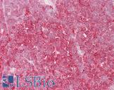 MCM6 Antibody - Anti-MCM6 antibody IHC of human thymus. Immunohistochemistry of formalin-fixed, paraffin-embedded tissue after heat-induced antigen retrieval. Antibody concentration 5 ug/ml.  This image was taken for the unconjugated form of this product. Other forms have not been tested.