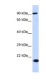 MCM7 Antibody - MCM7 antibody Western blot of 293T cell lysate. This image was taken for the unconjugated form of this product. Other forms have not been tested.