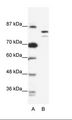 MCM8 Antibody - A: Marker, B: Jurkat Cell Lysate.  This image was taken for the unconjugated form of this product. Other forms have not been tested.