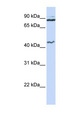 MCM9 Antibody - MCM9 antibody Western blot of Jurkat lysate. This image was taken for the unconjugated form of this product. Other forms have not been tested.