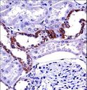 MCOLN1 / Mucolipin 1 Antibody - MCOLN1 Antibody immunohistochemistry of formalin-fixed and paraffin-embedded human kidney tissue followed by peroxidase-conjugated secondary antibody and DAB staining.